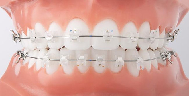 Orthodontics